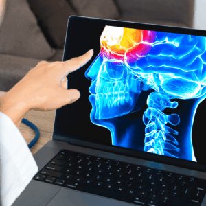 traumatic brain injury