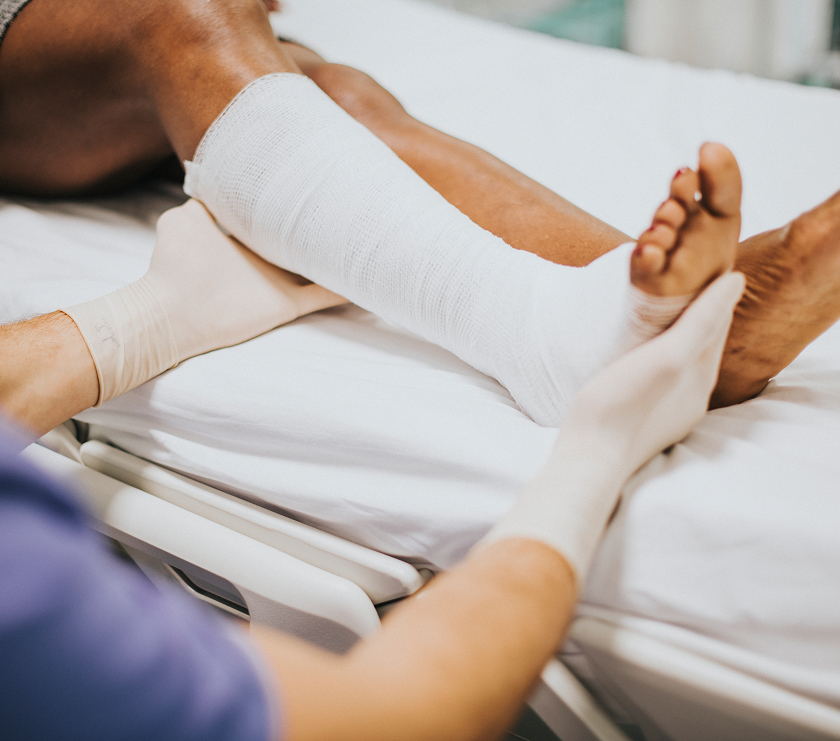 injured person with broken bone after slip and fall accident