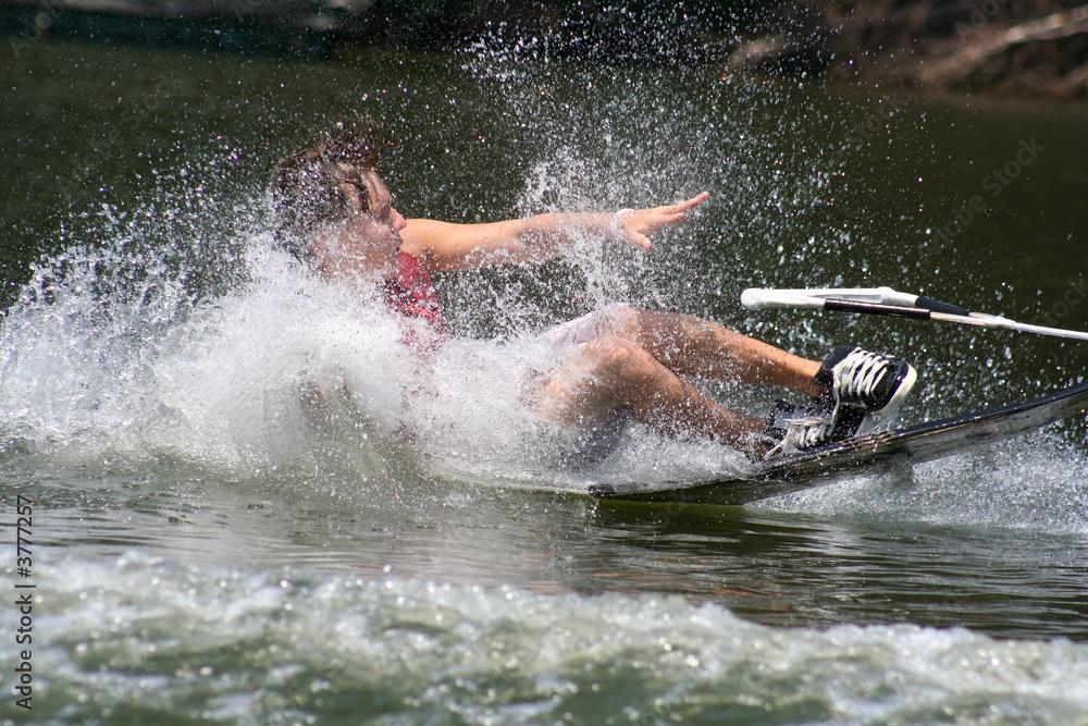 outdoor recreational water accident wakeboarding injury